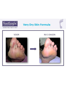 Footlogix Footlogix Very Dry Skin Formula tegen Droge Huid 3