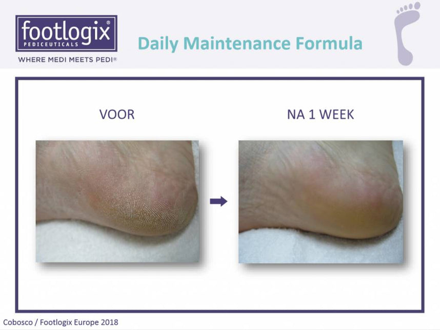 Footlogix Daily Maintenance Formula Nr. 2