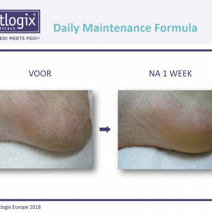Footlogix Footlogix Daily Maintenance Formula Nr. 2