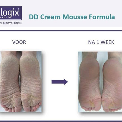 Footlogix Footlogix DD Cream Mousse voor Hydratatie Nr. 1