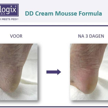 Footlogix Footlogix DD Cream Mousse voor Hydratatie Nr. 1