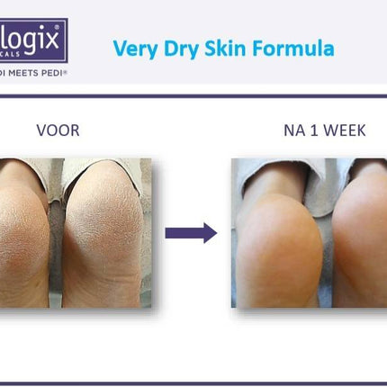 Footlogix Very Dry Skin Formula tegen Droge Huid 3